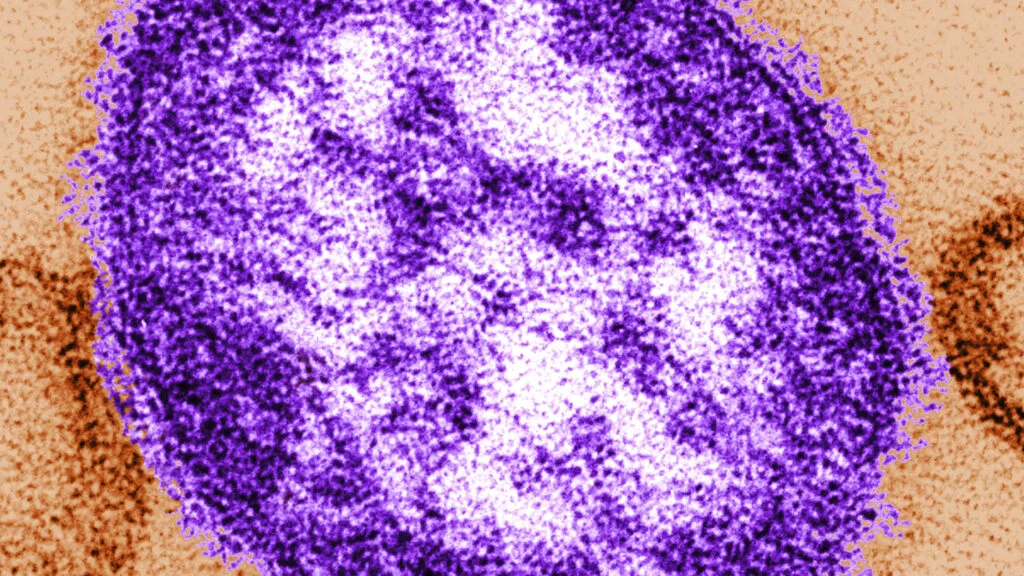 Measles Claims Third Life in Pennsylvania Amid Ongoing Outbreak